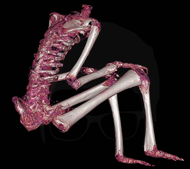 Huesos quebrados y astillados. Imagen 3D de la momia denominada Victoria, generada a partir de las tomografías que se realizaron a las «momias de Nasca», el 23 de enero del 2020 en Lima.