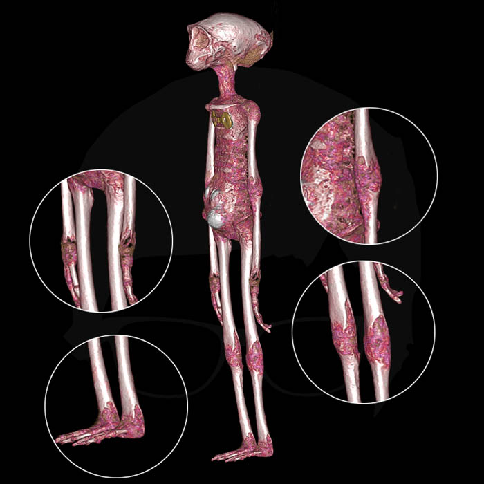 Huesos quebrados y astillados. Imagen 3D de la momia denominada Luisa, generada a partir de las tomografías que se realizaron a las «momias de Nasca», el 23 de enero del 2020 en Lima.